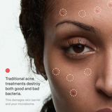 Acne Phage Serum by Phyla Skincare