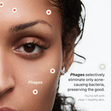 Acne Phage Serum by Phyla Skincare