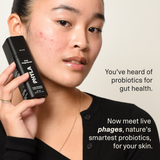 Acne Phage Serum by Phyla Skincare