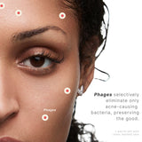 Acne Phage System by Phyla Skincare